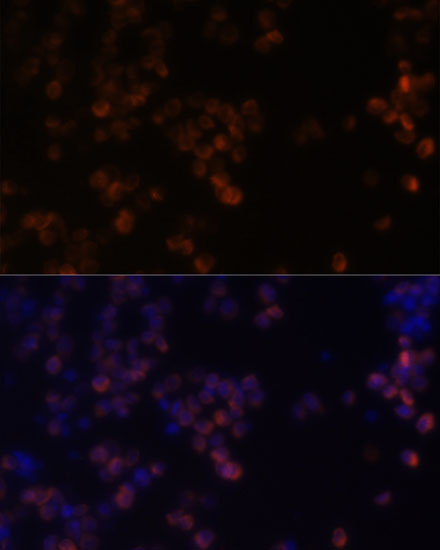 Anti-ZYX Antibody (CAB2135)