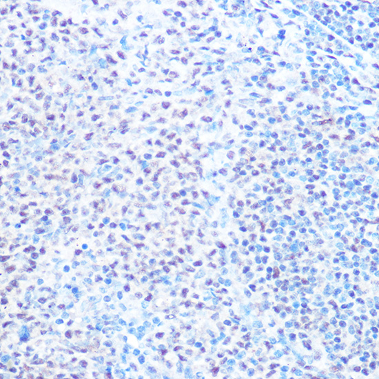 Anti-SNRPB Antibody (CAB2009)