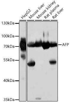 Anti-AFP Antibody (CAB16750)