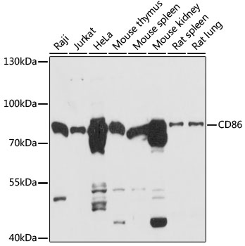 Anti-CD86 Antibody (CAB16805)