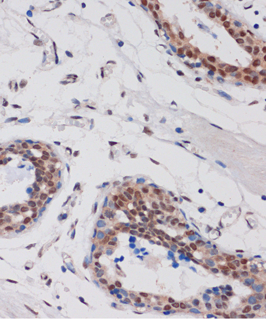 Anti-ARID1B Antibody (CAB15488)