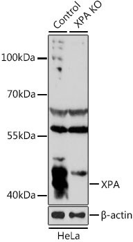 Anti-XPA Antibody [KO Validated] (CAB1626)