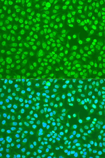 Anti-HNRNPDL Antibody (CAB10721)