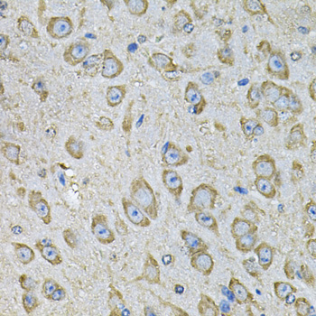 Anti-PDIA6 Antibody (CAB7055)