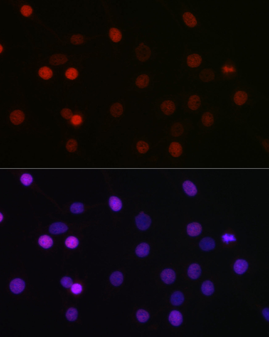 Anti-SETD8 Antibody (CAB5256)