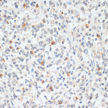 Anti-FOXP3 Antibody (CAB12051)