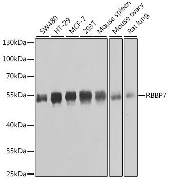 Anti-RBBP7 Antibody (CAB6967)