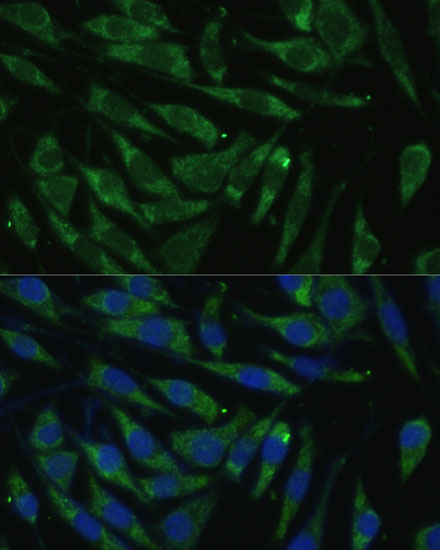 Anti-PITRM1 Polyclonal Antibody (CAB8362)