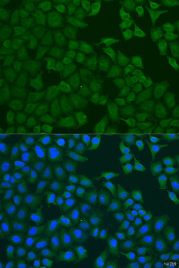 Anti-FERMT3 Antibody (CAB7839)