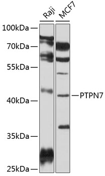 Anti-PTPN7 Antibody (CAB4062)