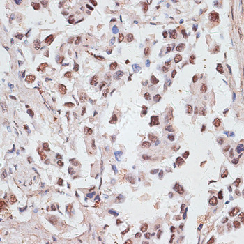 Anti-DKC1 Antibody (CAB12914)