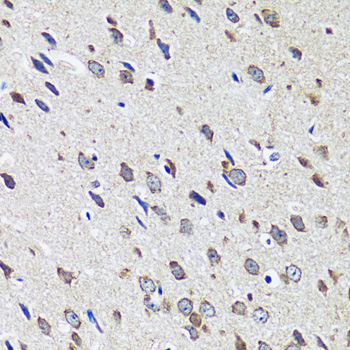 Anti-CCDC124 Antibody (CAB14436)