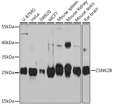 Anti-CSNK2B Antibody (CAB14722)