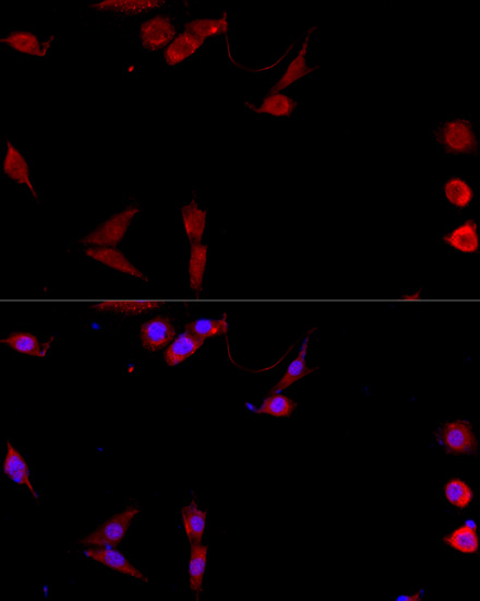 Anti-CD40L Antibody (CAB13002)