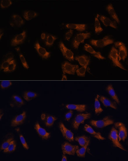 Anti-RPL36AL Antibody (CAB14366)