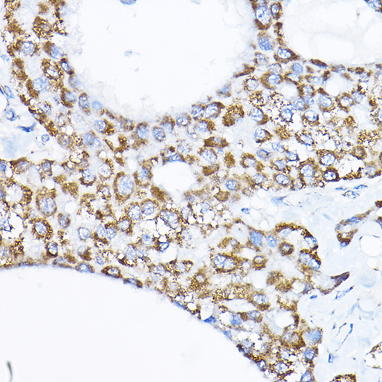 Anti-SAMM50 Antibody (CAB3401)