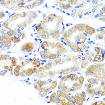 Anti-DLG1 Polyclonal Antibody (CAB8542)