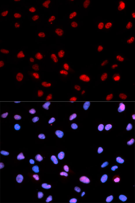 Anti-Phospho-RB-S795 Antibody (CABP0088)