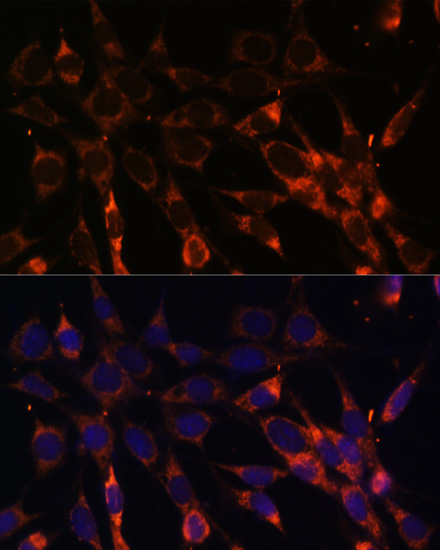 Anti-Smad6 Antibody (CAB14749)