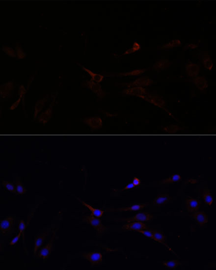 Anti-SUCLG1 Antibody (CAB15345)