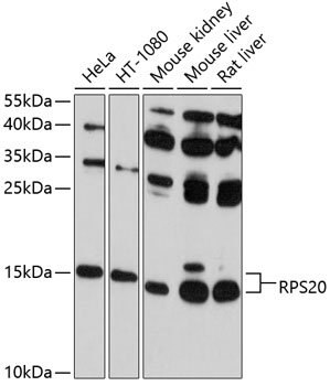 Anti-RPS20 Antibody (CAB10363)