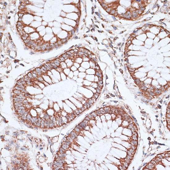 Anti-KCNS3 Antibody (CAB7906)