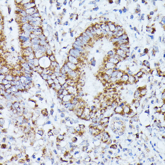 Anti-PPP2CB Antibody (CAB3122)