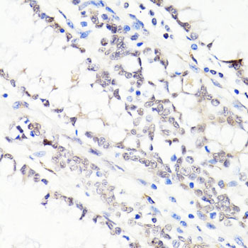 Anti-FKBP5 Antibody (CAB3863)