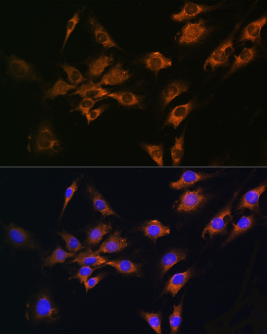 Anti-FGF2 Antibody (CAB0235)