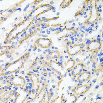 Anti-IRAK2 Antibody (CAB2753)