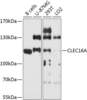 Anti-Protein CLEC16A Polyclonal Antibody (CAB9753)