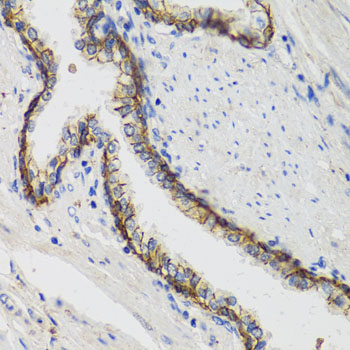 Anti-ATP1A Antibody (CAB0643)