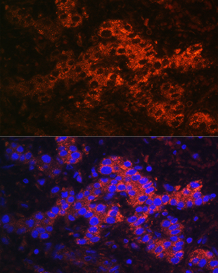 Anti-Ceruloplasmin Antibody (CAB13660)