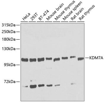 Anti-KDM7A Polyclonal Antibody (CAB8266)