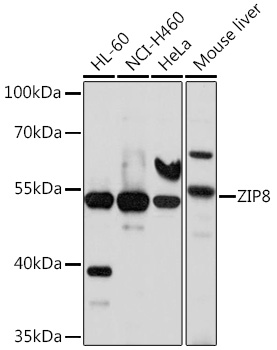 Anti-ZIP8 Antibody (CAB10395)