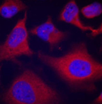 Anti-Phospho-Alpha-adducin-S726 Antibody (CABP0196)