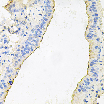 Anti-HPR Polyclonal Antibody (CAB9898)