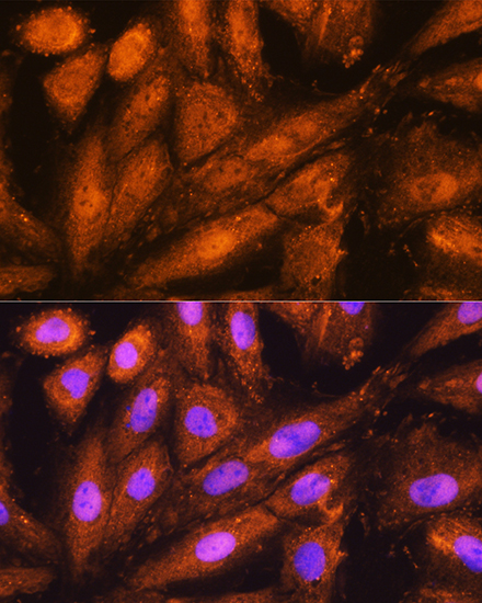 Anti-PSMD4 Antibody (CAB1061)