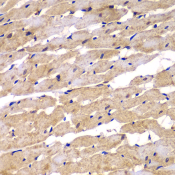 Anti-PSEN2 Antibody (CAB7719)