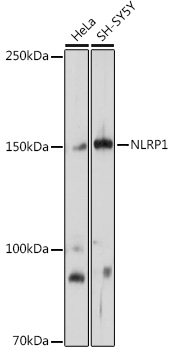 Anti-NLRP1 Antibody (CAB16212)