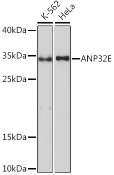 Anti-ANP32E Antibody (CAB17220)