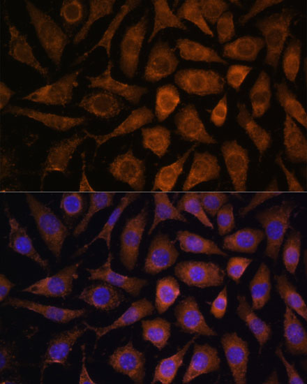 Anti-MAPK6 Antibody [KO Validated] (CAB15304)