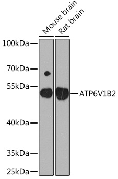 Anti-ATP6V1B2 Antibody (CAB16770)