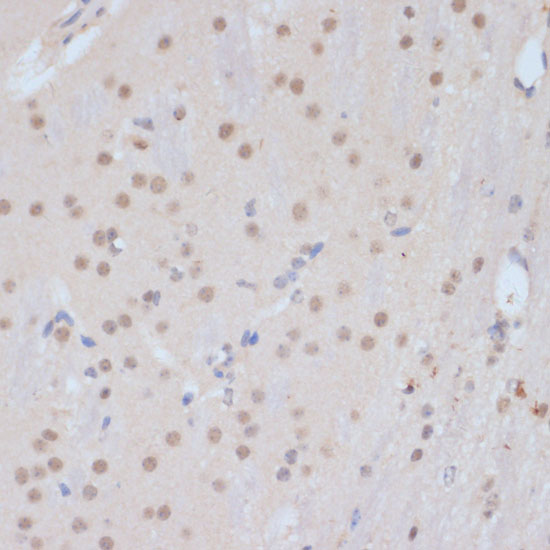 Anti-CDK9 Antibody (CAB0886)