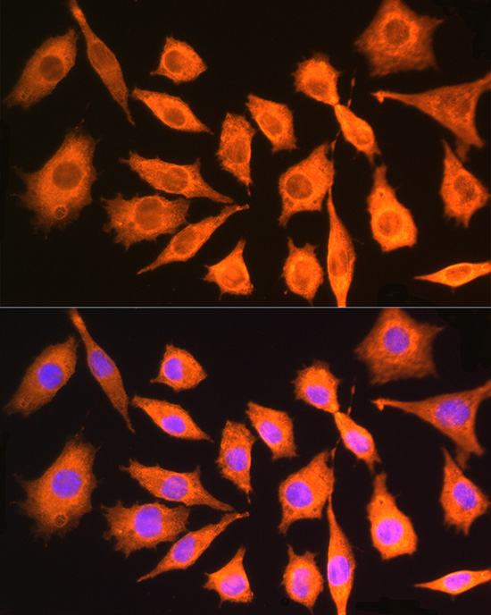 Anti-CKAP5 Polyclonal Antibody (CAB8532)