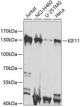 Anti-KIF11 Antibody (CAB7907)