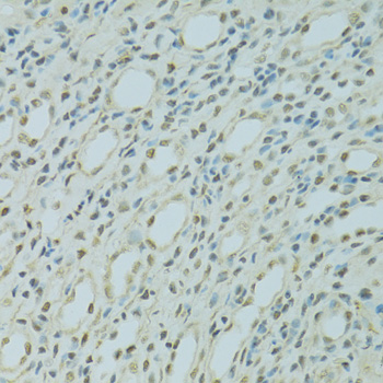 Anti-SAFB Antibody (CAB7927)