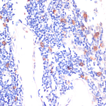 Anti-Protein Wnt-5b Polyclonal Antibody (CAB8313)