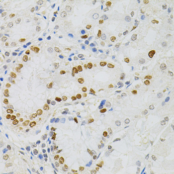 Anti-MCM2 Antibody (CAB0502)