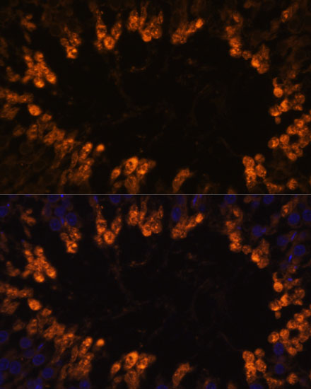 Anti-OXCT2 Antibody (CAB14920)